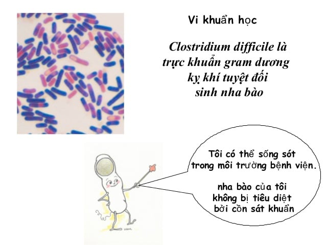 Nhiễm vi khuẩn Clostridium difficile (C. Diff) - Ảnh minh họa 1