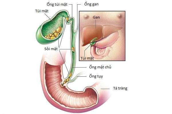 OMC - Ảnh minh họa 2