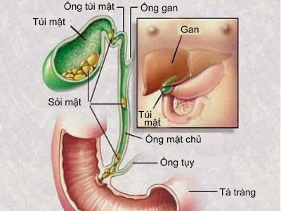 OMC - Ảnh minh họa 4