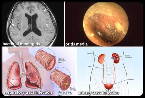 Nhiễm trùng do virus - Ảnh minh họa 1