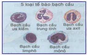 Bạch cầu Lympho mạn tính (CLL) - Ảnh minh họa 2