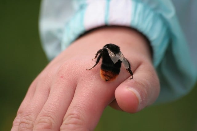 Bee Sting - Ảnh minh họa 1