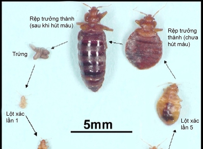 Bed bugs bite - Ảnh minh họa 2