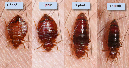 Bed bugs bite - Ảnh minh họa 4