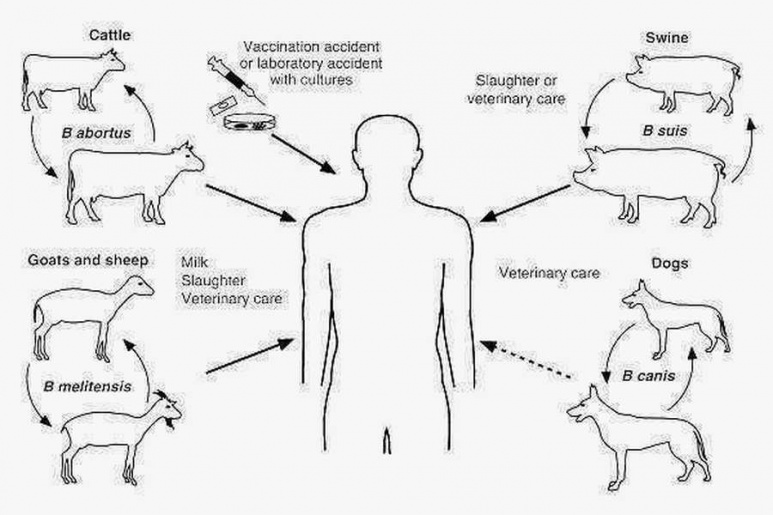 Brucellosis - Ảnh minh họa 3