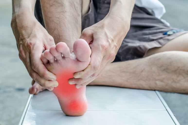 Plantar Fasciitis - Ảnh minh họa 5