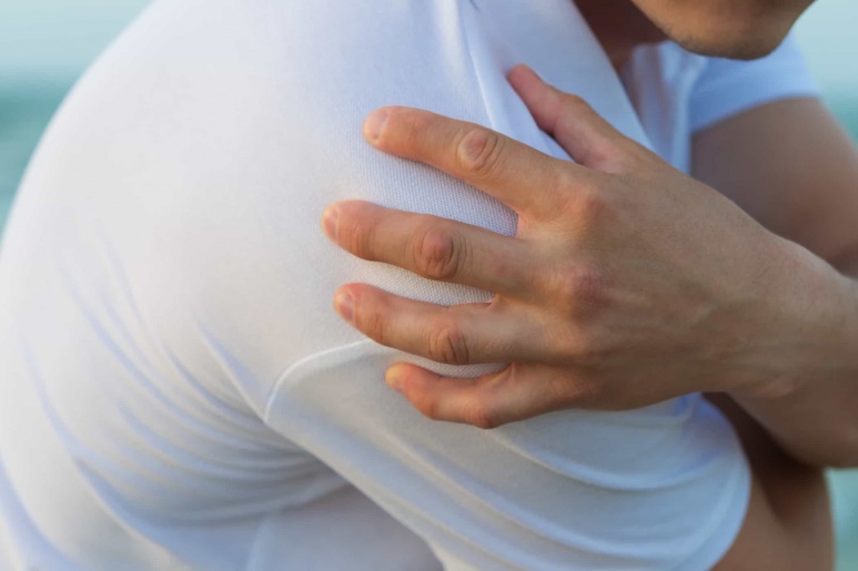 Polymyalgia rheumatica - Ảnh minh họa 3