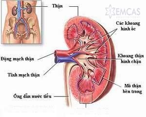 Polycystic Kidney Disease - Ảnh minh họa 2