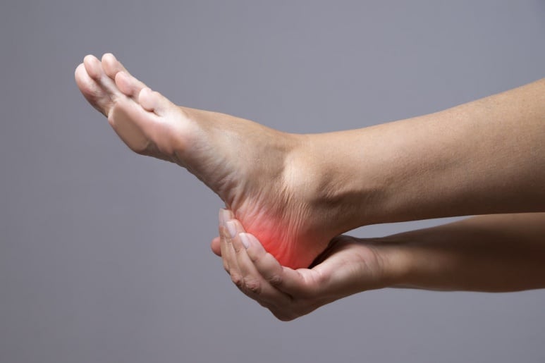 Plantar Fasciitis - Ảnh minh họa 3