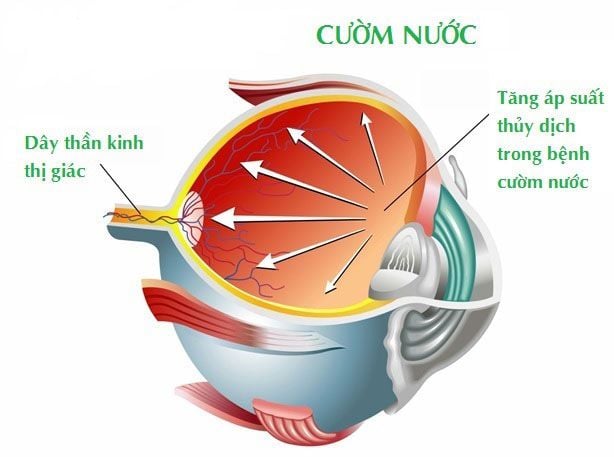 Cườm nước - Ảnh minh họa 3