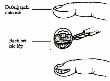 Chín mé - Ảnh minh họa 3