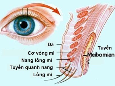 Chắp và lẹo - Ảnh minh họa 2