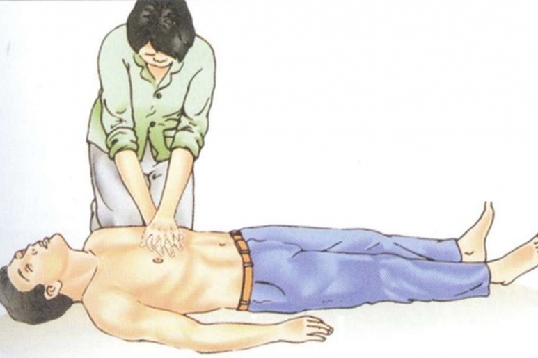 Cardiac arrest - Ảnh minh họa 1