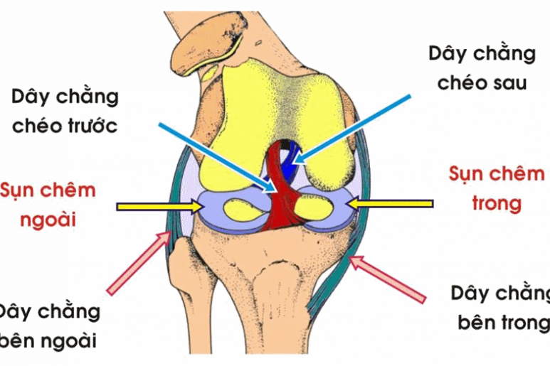 Rách sụn chêm đầu gối - Ảnh minh họa 2