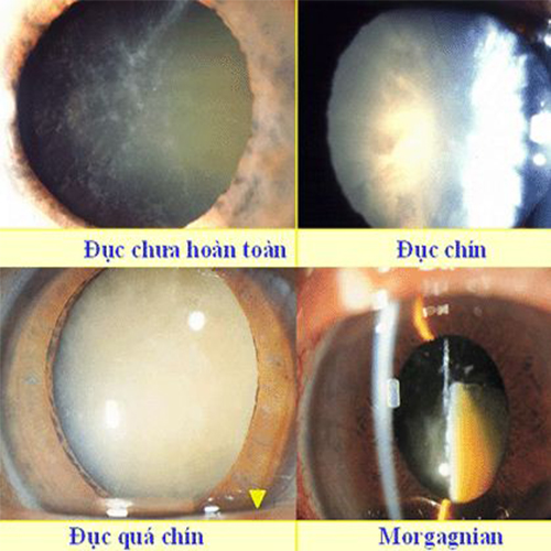 Phacoscotasmus - Ảnh minh họa 3