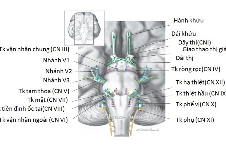 Rối loạn dây thần kinh sọ não số III - Ảnh minh họa 3