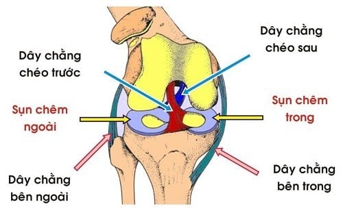 Rách dây chằng - Ảnh minh họa 4