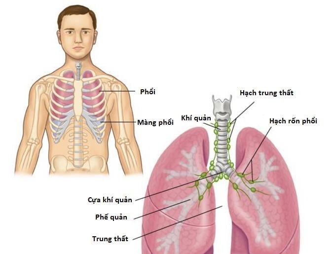 Small-cell Carcinoma - Ảnh minh họa 2