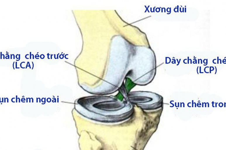 Chấn thương dây chằng chéo sau khớp gối - Ảnh minh họa 3