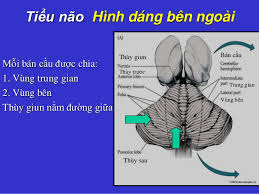 Chảy máu tiểu não - Ảnh minh họa 3