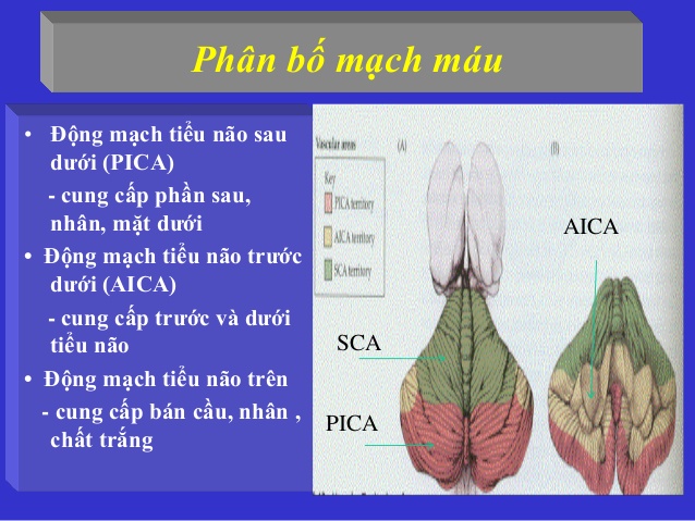 Chảy máu tiểu não - Ảnh minh họa 4