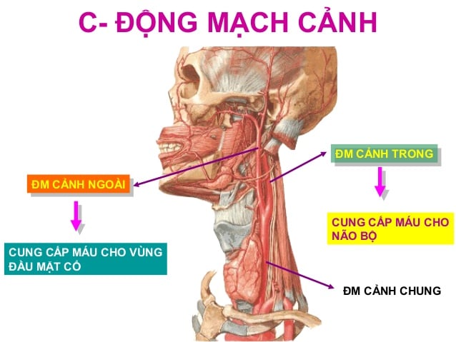 Rách động mạch cảnh (rách động mạch cổ) - Ảnh minh họa 2