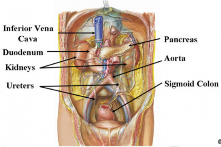 Retroperitoneal hemorrhage - Ảnh minh họa 4