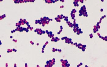 Streptococcus - Ảnh minh họa 3