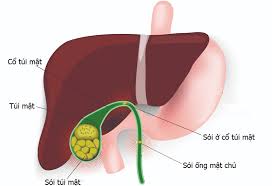 Cơn đau quặn mật - Ảnh minh họa 1