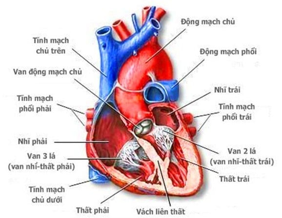 Congenital heart defect - Ảnh minh họa 4