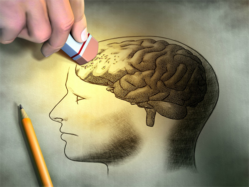 Temporal Lobe Epilepsy - Ảnh minh họa 3