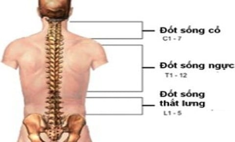 Thoái hóa cột sống ngực - Ảnh minh họa 2