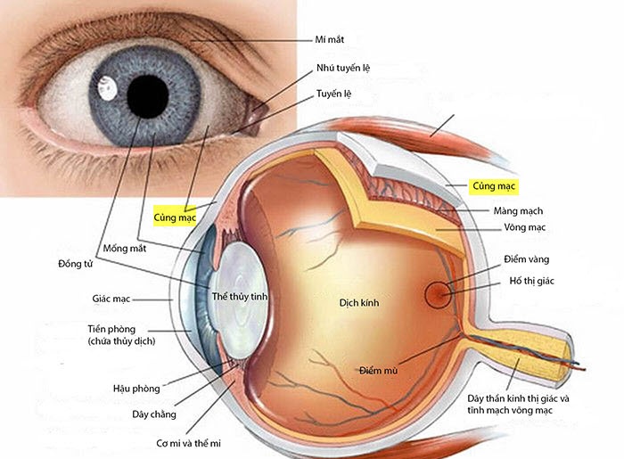 Scleritis - Ảnh minh họa 1