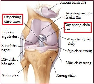 Chấn thương dây chằng chéo trước (Khớp gối) - Ảnh minh họa 2