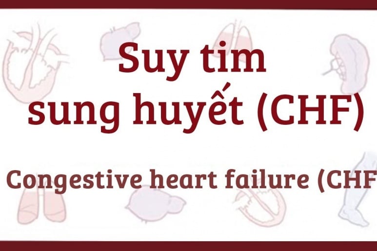 Congestive Cardiac Failure(CHF) - Ảnh minh họa 5