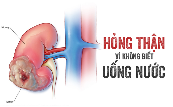 Chấn thương thận - Ảnh minh họa 3