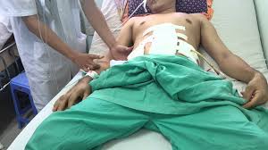 Chấn thương bụng - Ảnh minh họa 3