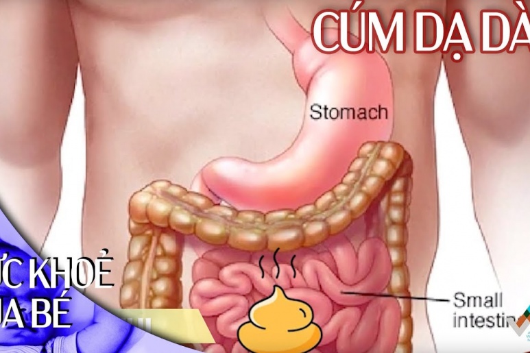 Cúm dạ dày - Ảnh minh họa 4