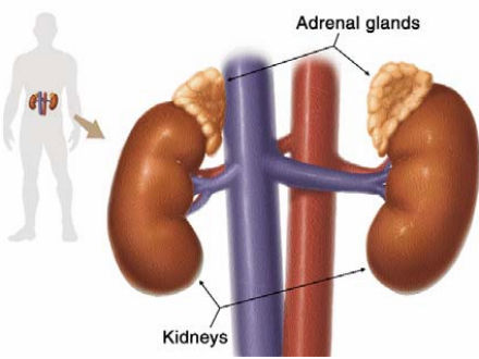 Congenital adrenal hyperplasia - Ảnh minh họa 4
