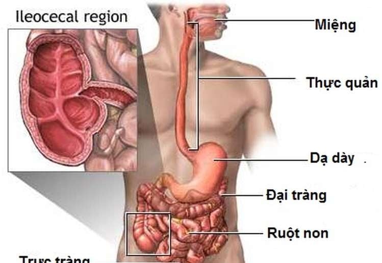 Crohn - Ảnh minh họa 1