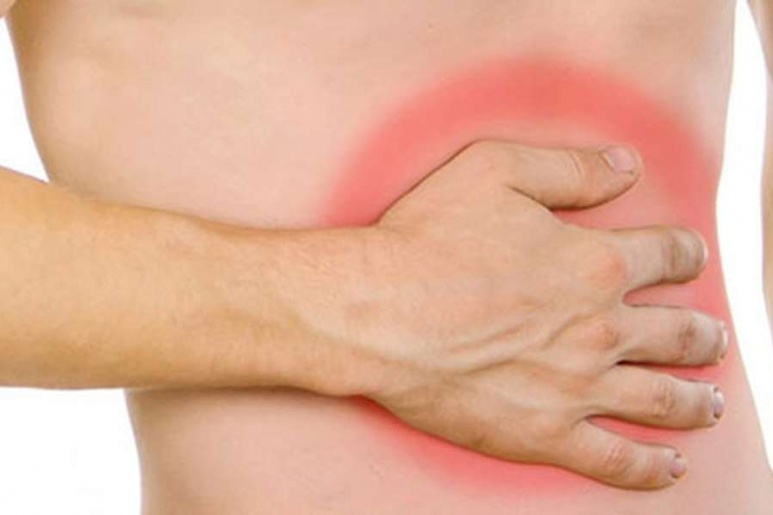 Crohn - Ảnh minh họa 3