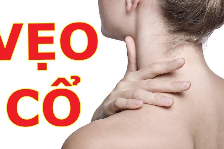 Cervical dystonia - Ảnh minh họa 2