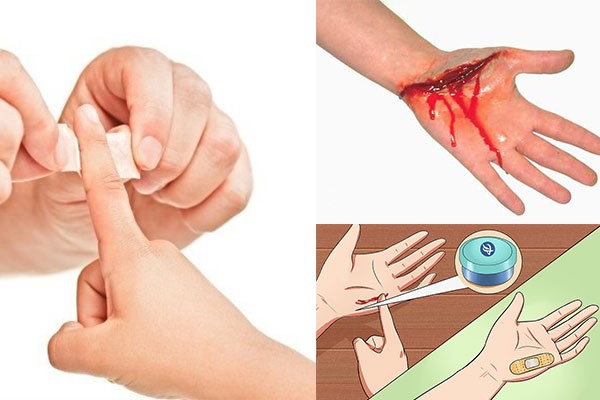 Vết thương thủng ở ngón chân - Ảnh minh họa 2