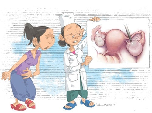 U nang buồng trứng xoắn - Ảnh minh họa 4