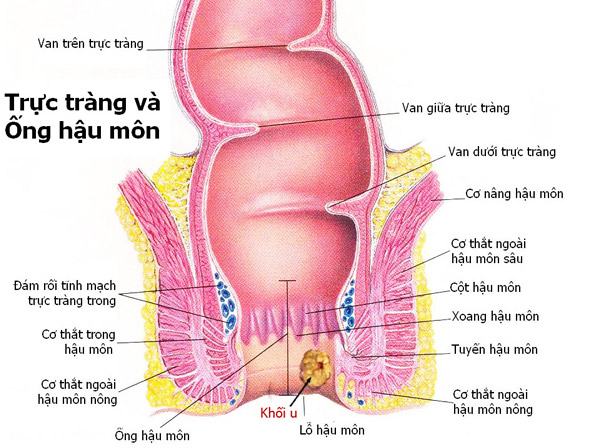 Ung thư ống hậu môn - Ảnh minh họa 2