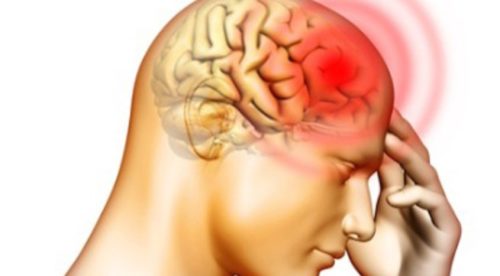 Viêm màng não do Haemophilus - Ảnh minh họa 3
