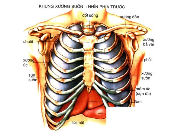 Viêm sụn sườn - Ảnh minh họa 3