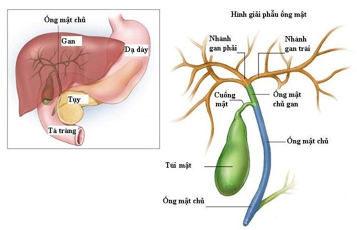 Ung thư ống mật và túi mật - Ảnh minh họa 3