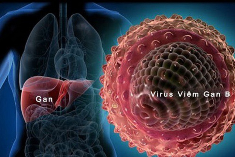 Viêm gan B - Ảnh minh họa 2
