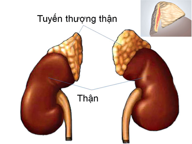 Ung thư tuyến thượng thận - Ảnh minh họa 4